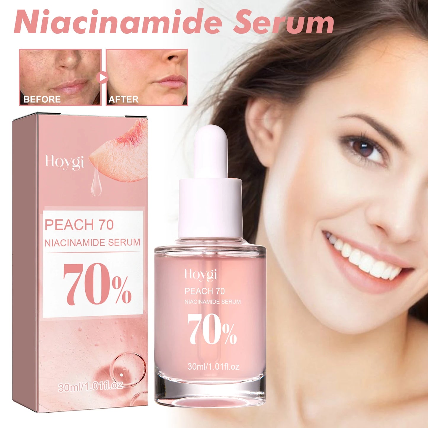 Niacinamide Serum 30ml, Brightening Pore Minimizer, Fades Dark Spots, Hydrating, Evens Skin Tone, Anti-Aging, for Face, Non-Irritating