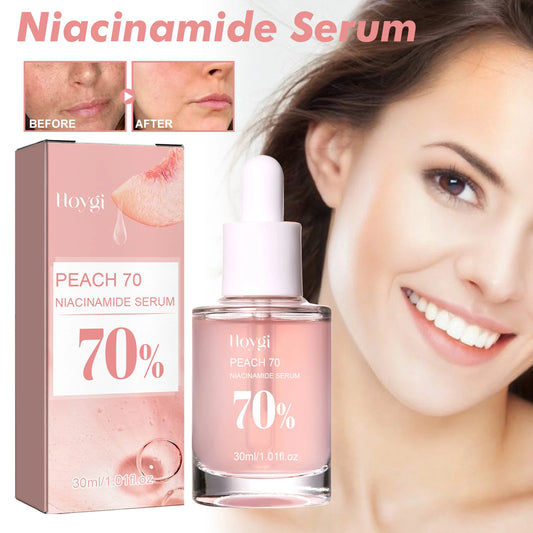 Sérum Niacinamide 30ml — Minimiseur Pores, Anti-Taches & Hydratant Visage