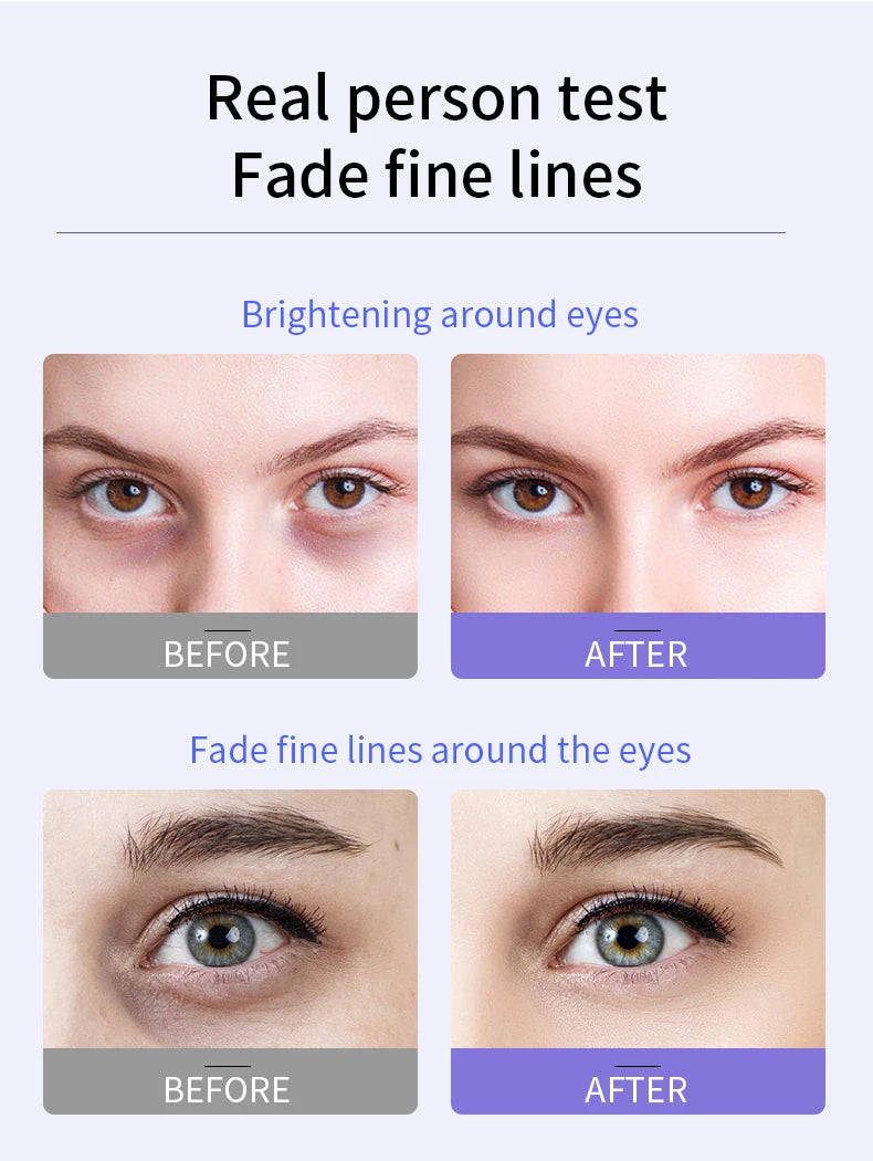 O'CHEAL – Crema antiarrugas para ojos con bola rodante, secado rápido, hidratante, ácido hialurónico, suero refrescante para ojos, atenúa las líneas finas