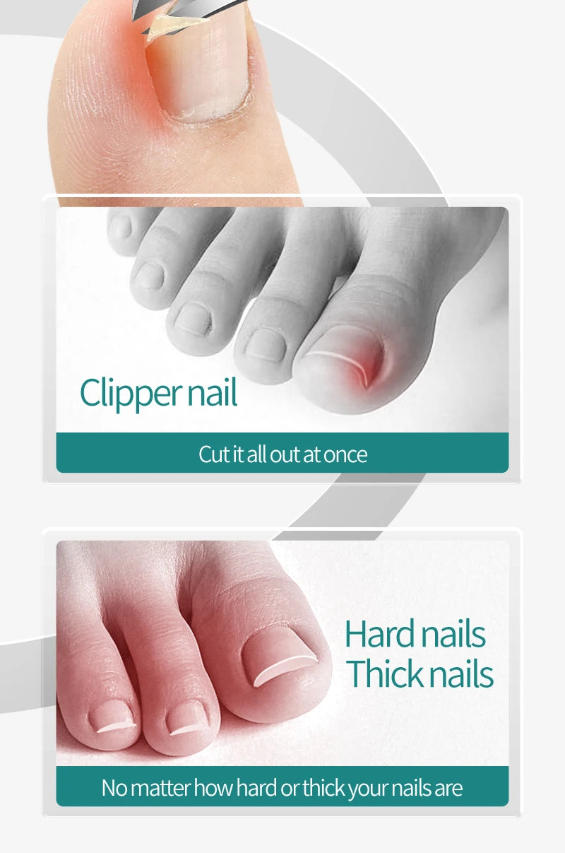Coupe-ongles pour ongles incarnés ou épais, coupe-ongles professionnel pour podologue, pince à ongles avec acier inoxydable Ultra