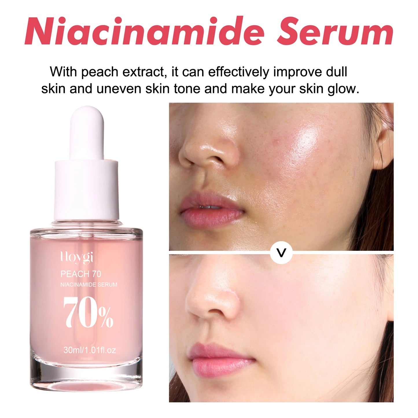 Niacinamide Serum 30ml, Brightening Pore Minimizer, Fades Dark Spots, Hydrating, Evens Skin Tone, Anti-Aging, for Face, Non-Irritating
