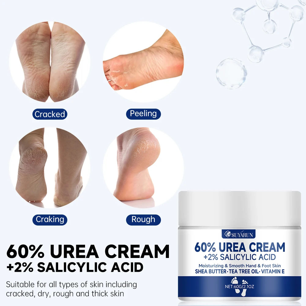 Crème Pieds à l’Urée 60% — Talons Craquelés, Peau Sèche & Callosités