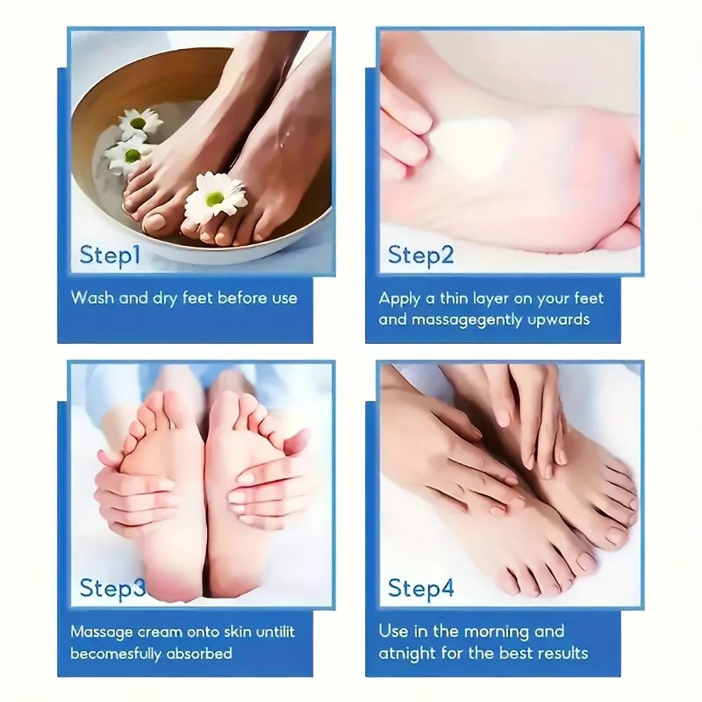 Crème Pieds à l’Urée 60% — Talons Craquelés, Peau Sèche & Callosités