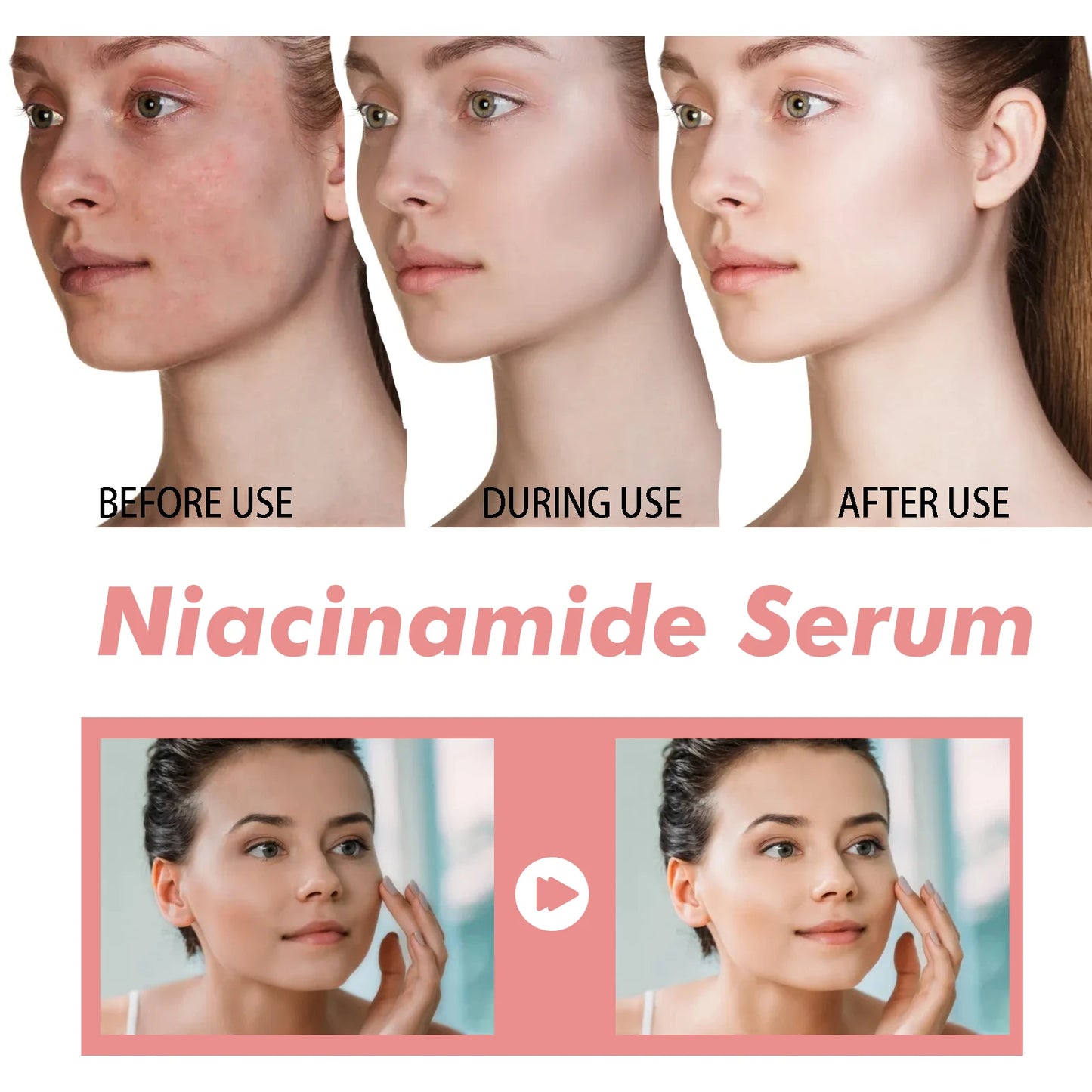 Niacinamide Serum 30ml, Brightening Pore Minimizer, Fades Dark Spots, Hydrating, Evens Skin Tone, Anti-Aging, for Face, Non-Irritating