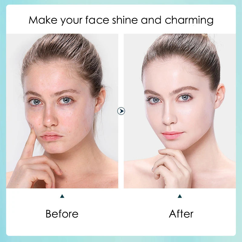 10 Masques Visage à l’Acide Hyaluronique — Hydratant & Rétrécissement des Pores
